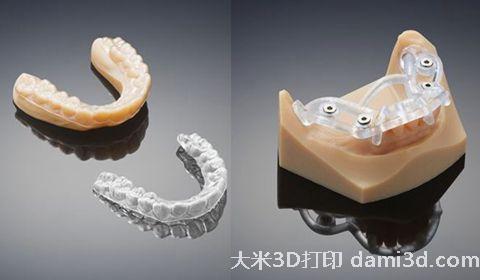 3D打印牙模480-280.jpg