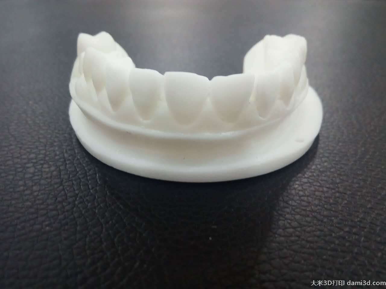3d打印为隐形牙套提供精密原型,帮助患者回复自信笑容